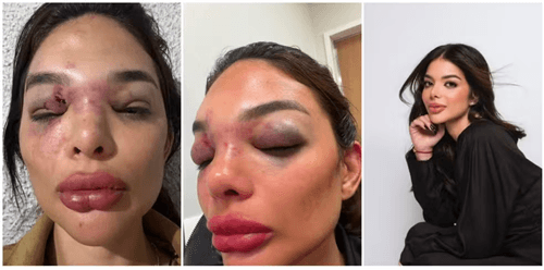 Empresário preso por suspeita de agredir mulher já foi alvo de acusação da CVM