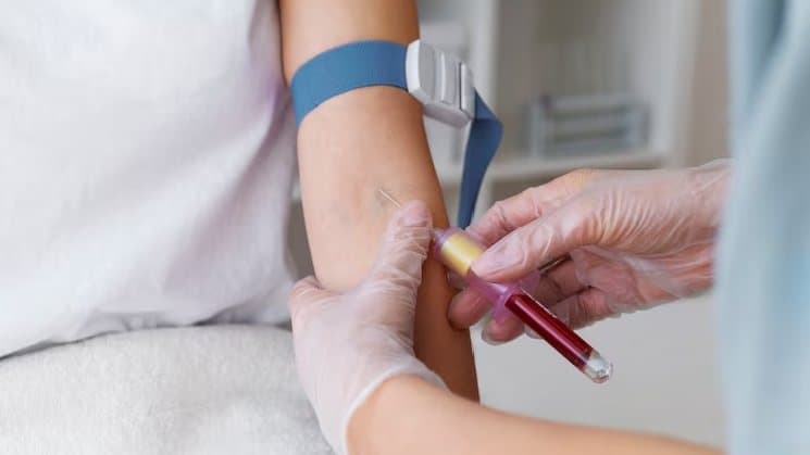 Novo exame de sangue capaz de detectar mais de 50 tipos de câncer chega ao Brasil